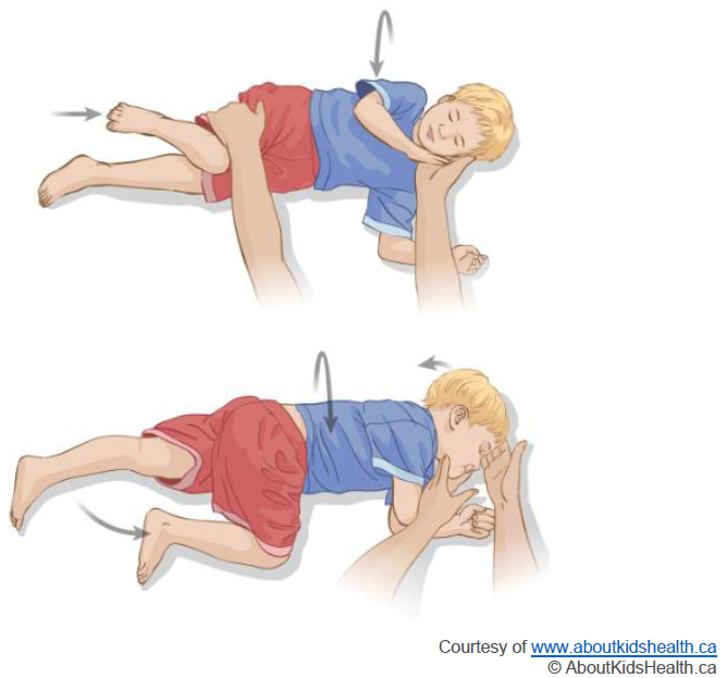 Group A Streptococcus and Scarlet Fever :: Hertfordshire and West Essex  Healthier Together